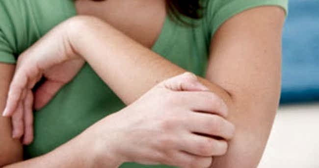 EVDE KAŞINIYORUZ BÖCEK OLABİLİRMİ...