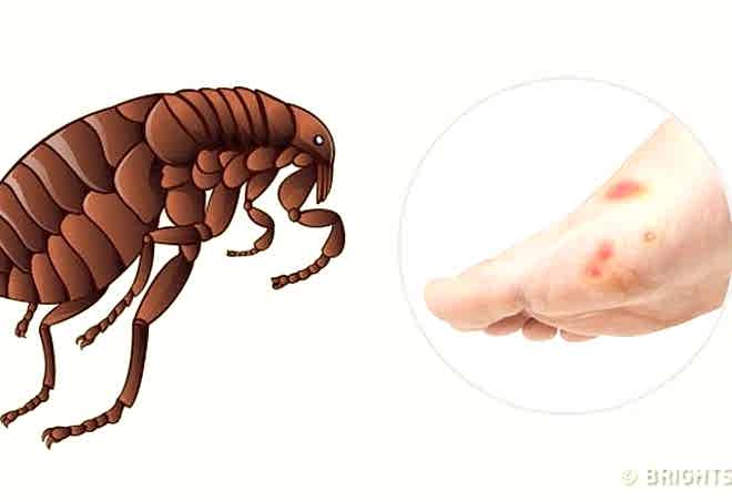 BACAKLARIMIZDA KAŞINTI VAR SEBEBİ PİRE OLABİLİRMİ...