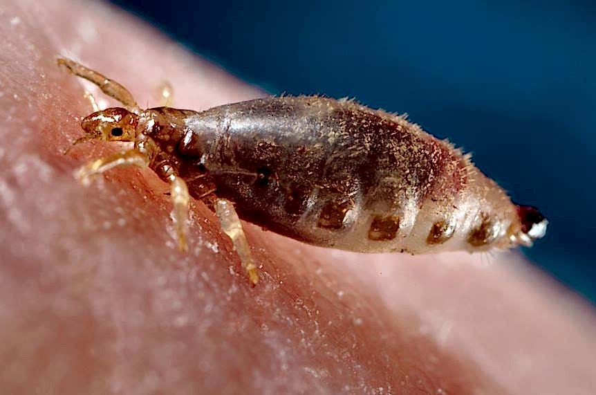 Yaz Geldi Haşerelere Dikkat, Bit, Hamam Böceği İlaçlama...